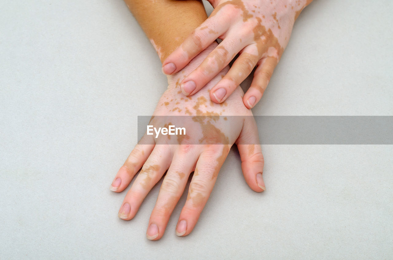 HIGH ANGLE VIEW OF HANDS OF WOMAN WITH KNIFE