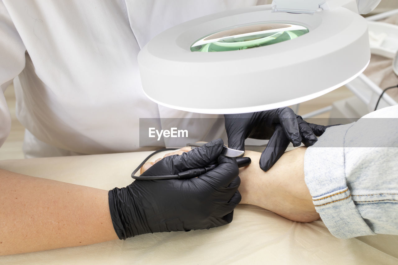 Cropped electrologist remove hair on woman's toes, foot with hair removal electrolysis procedure