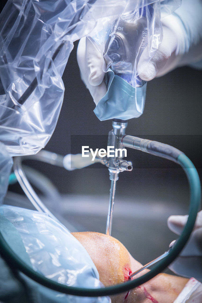 Cropped hand of surgeon operating patient at hospital