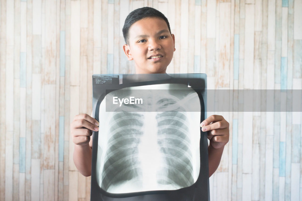 Young teen holding his x-ray film. concept of health care