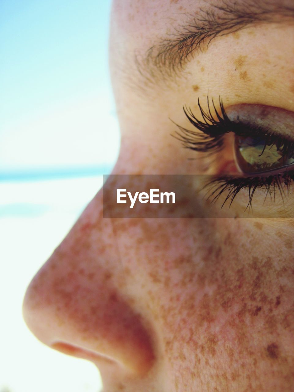 Cropped image of person with freckles
