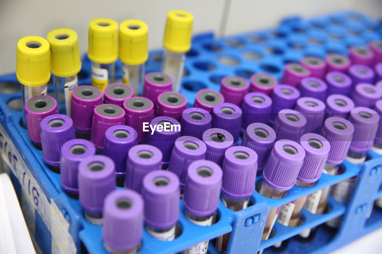 Close-up of test tubes in rack