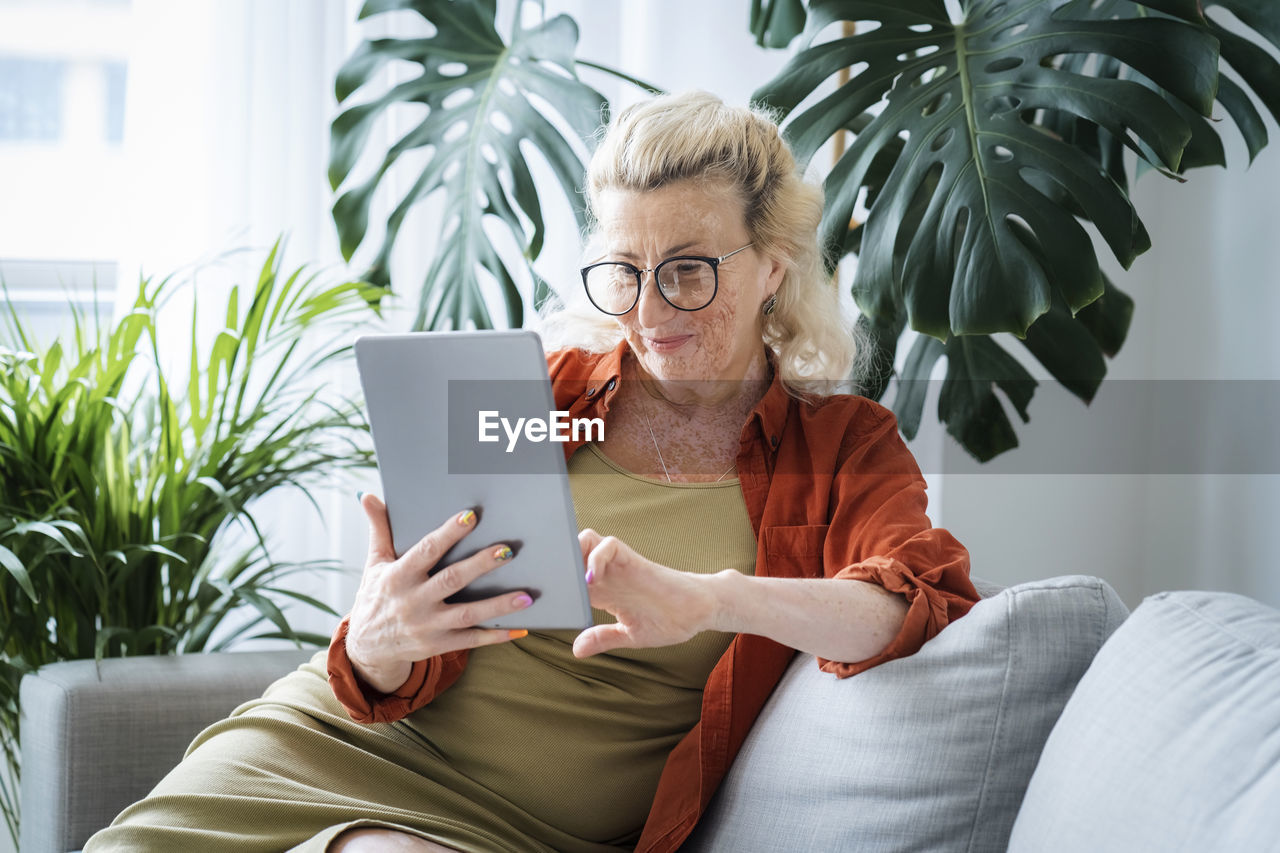 Smiling woman with vitiligo skin using tablet pc sitting on sofa at home