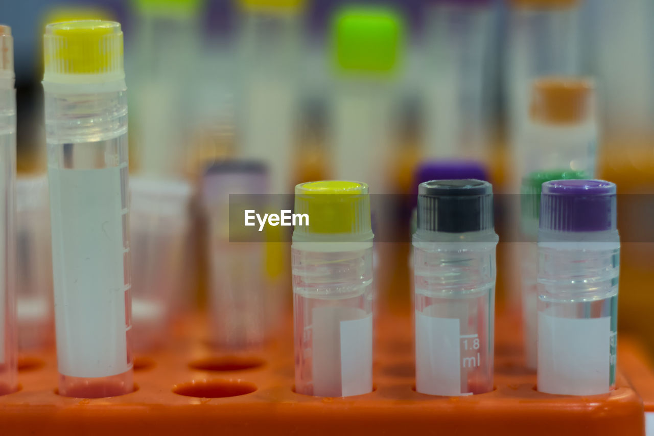 Close-up of samples in test tube rack