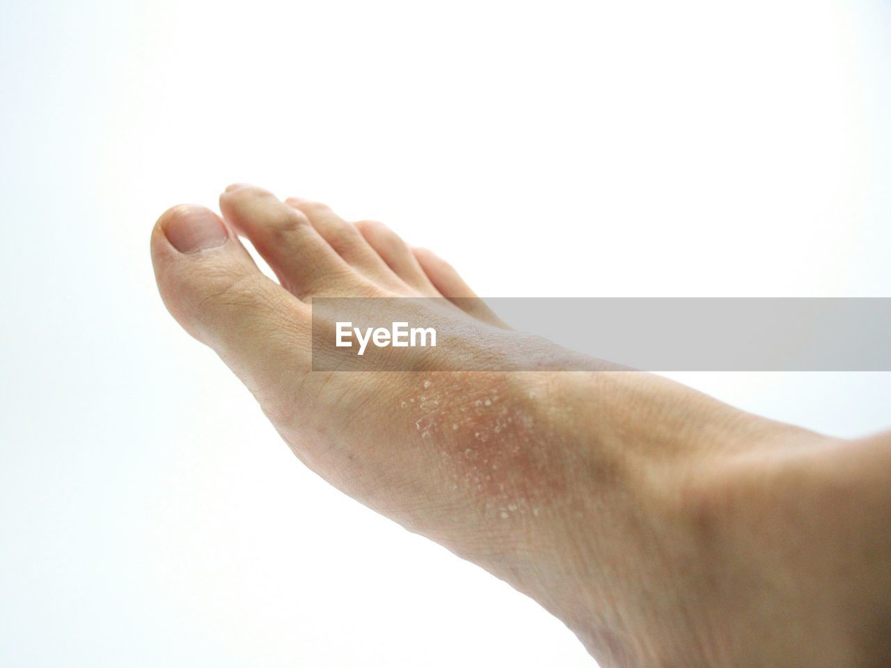 CLOSE-UP OF HUMAN HAND ON WHITE BACKGROUND