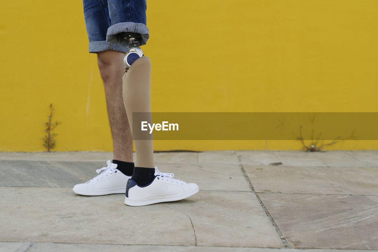 Man with leg prosthesis standing on street