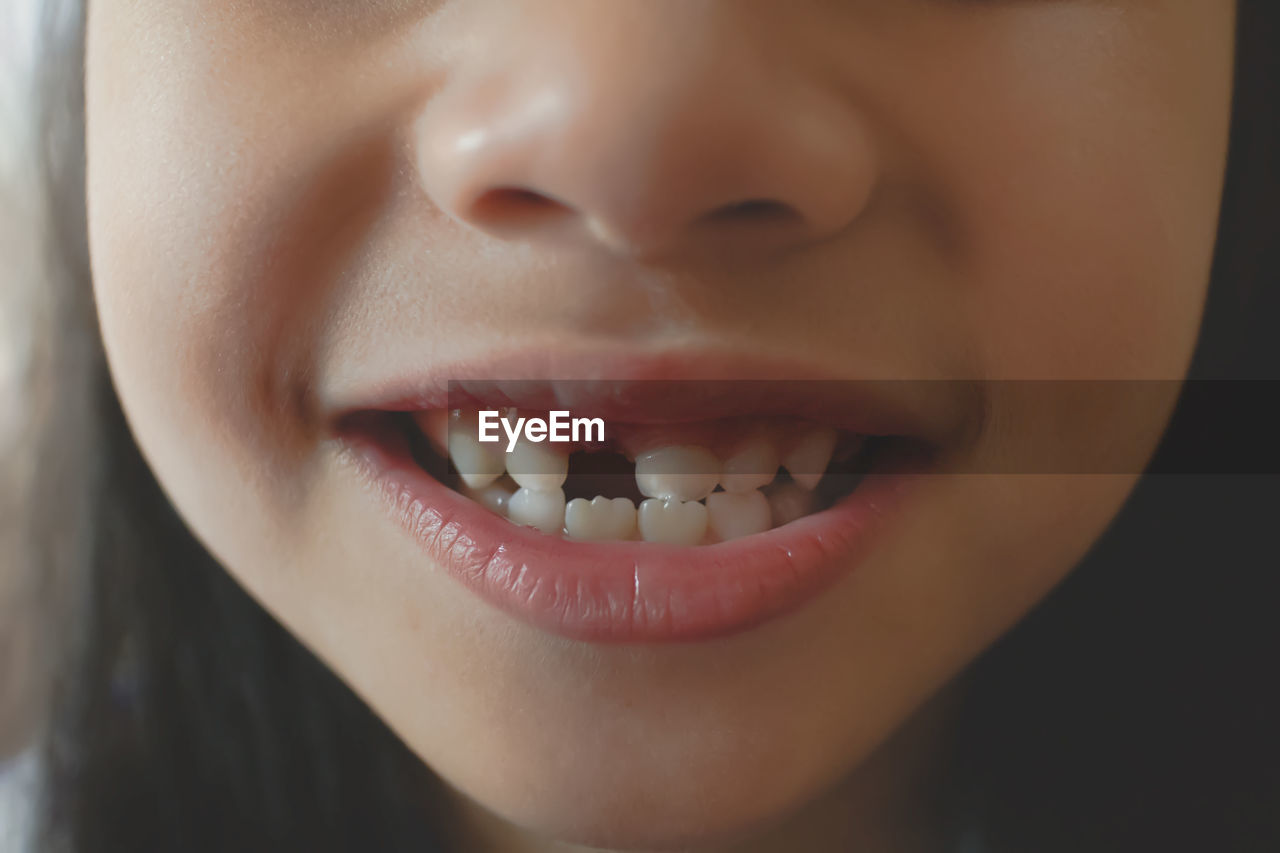 Little girl losing his first tooth