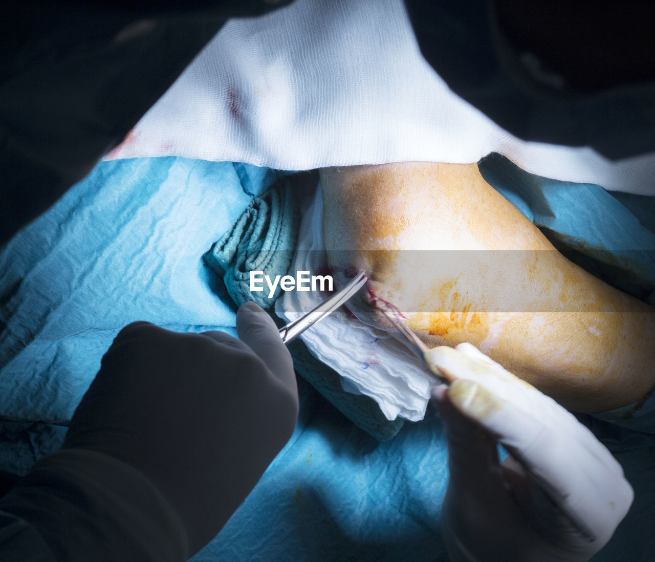 Cropped hands of surgeons doing knee surgery in hospital