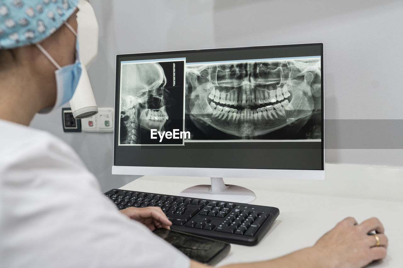 Dentist examining x-ray image on computer at medical clinic