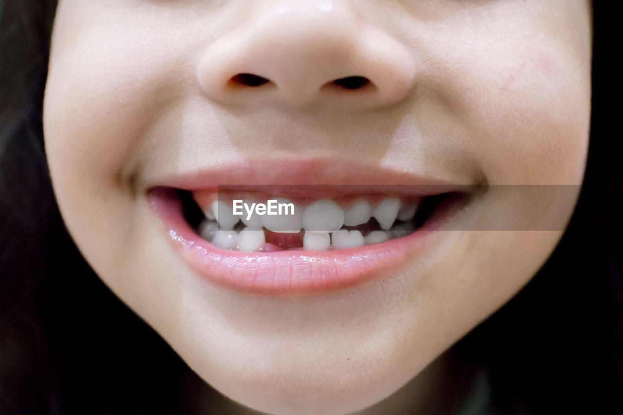 Little girl smile losing his first tooth