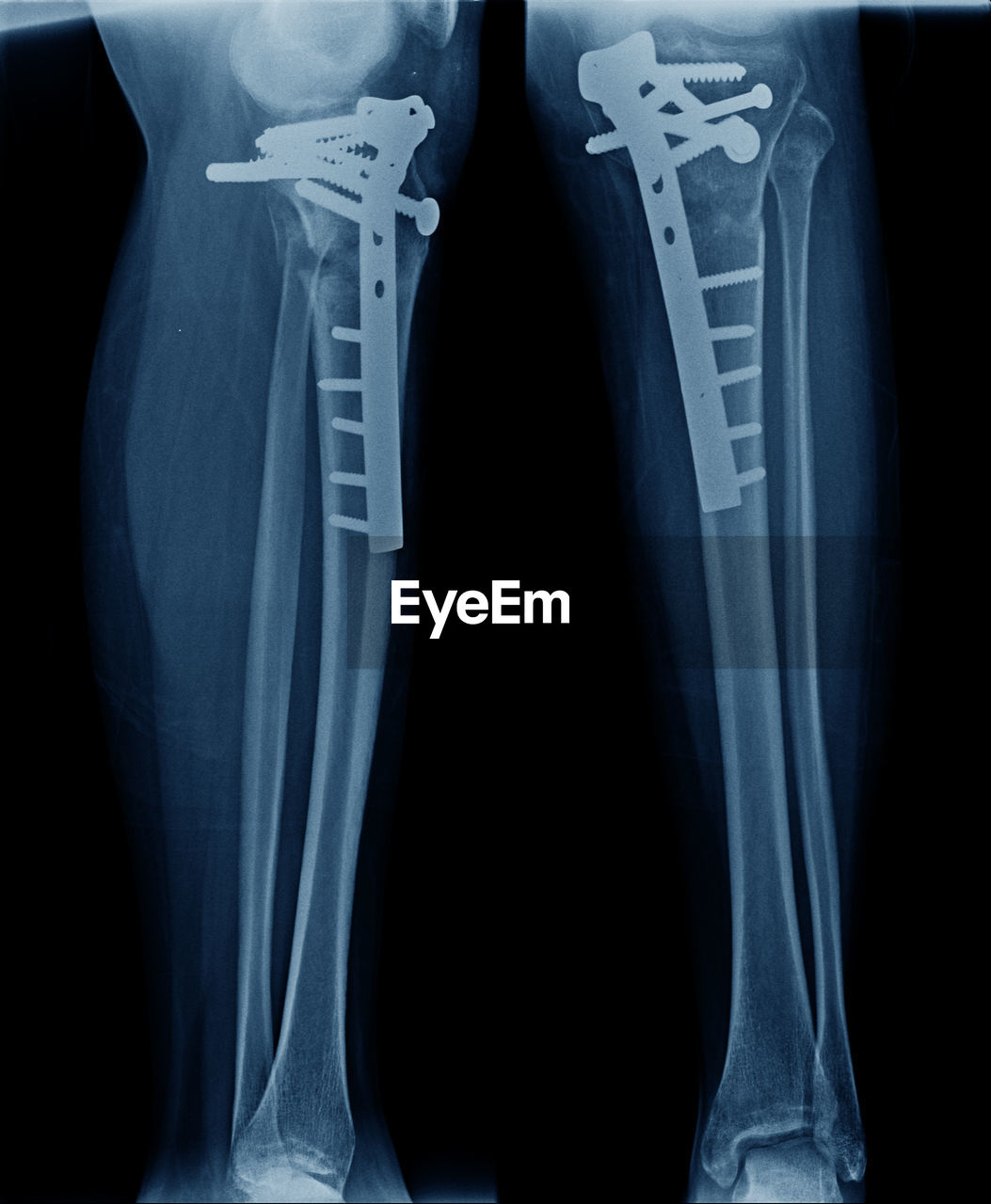 Full frame shot of x-ray