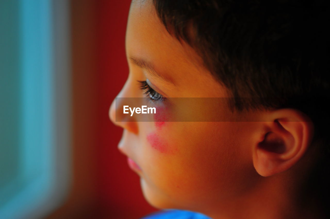 Close-up of boy with scars on face at home