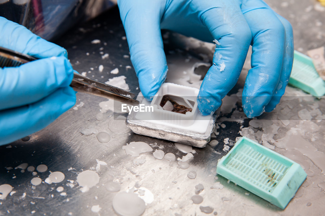 Scientist embedding tissues in paraffin blocks for sectioning. pathology laboratory. 