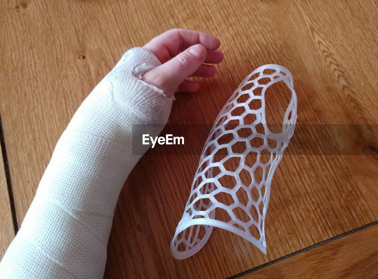 Close-up of woman with fractured hand on table