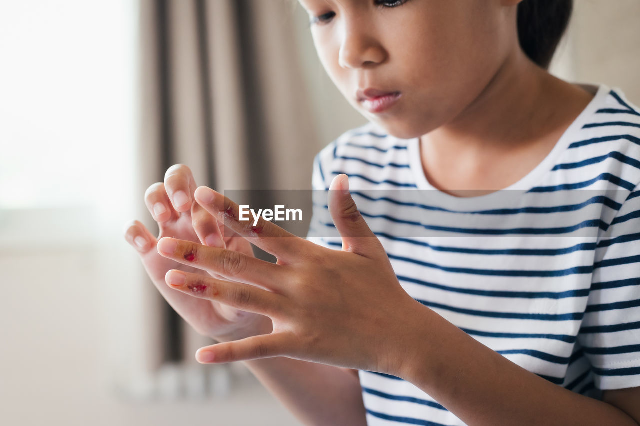 Fresh wound and blood from injured on child fingers after she has been an accident.