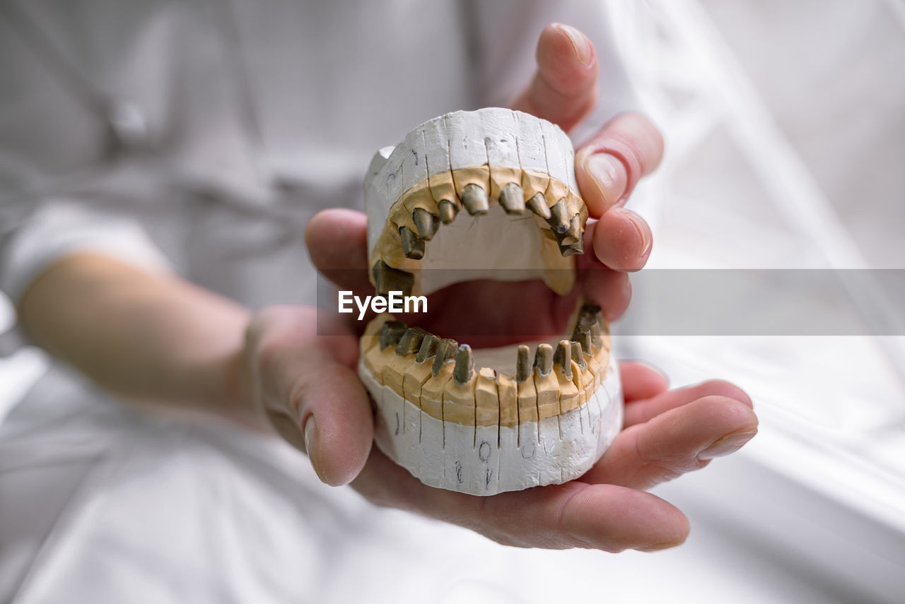 Tooth casts for prosthetics