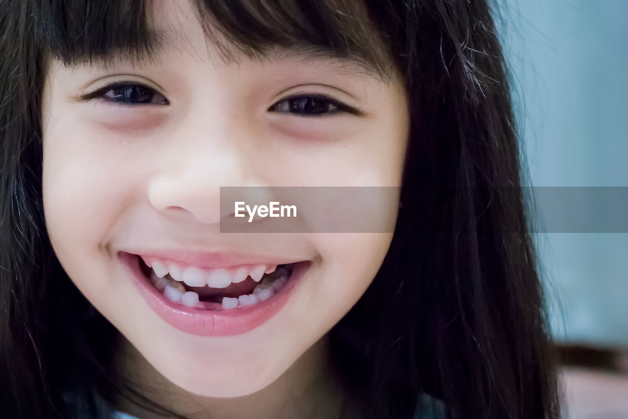 Cute little girl showing her broken milk teeth