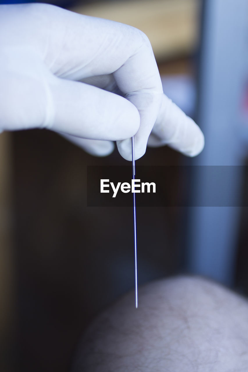 Close-up of hand holding acupuncture needle 