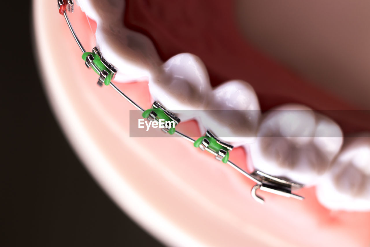 Close-up of dental equipment