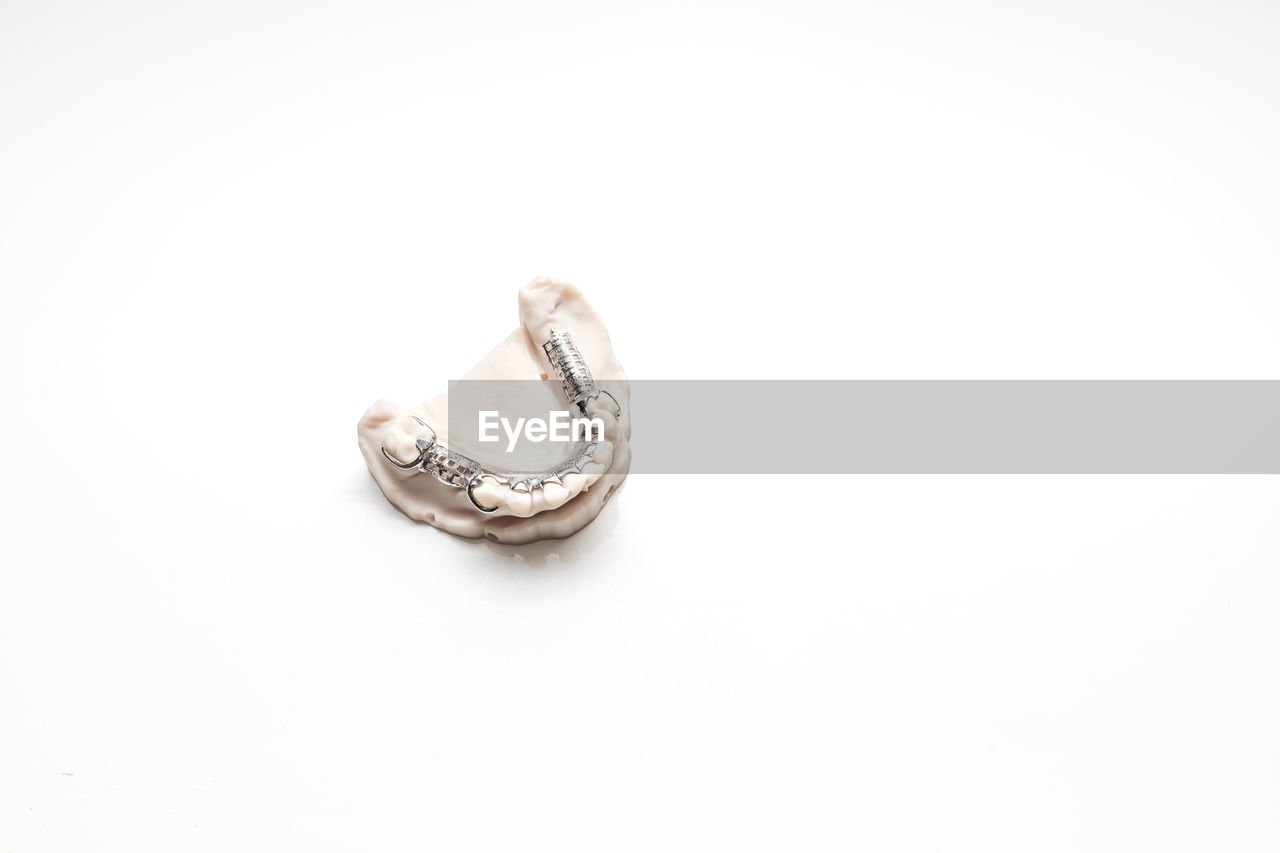 Isolated metal frame lower partial denture on die stone, plaster cast mold of lower jaws, cobalt