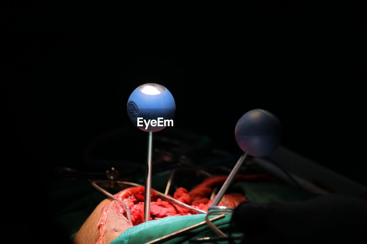 Close-up of medical equipment on patient in operating room