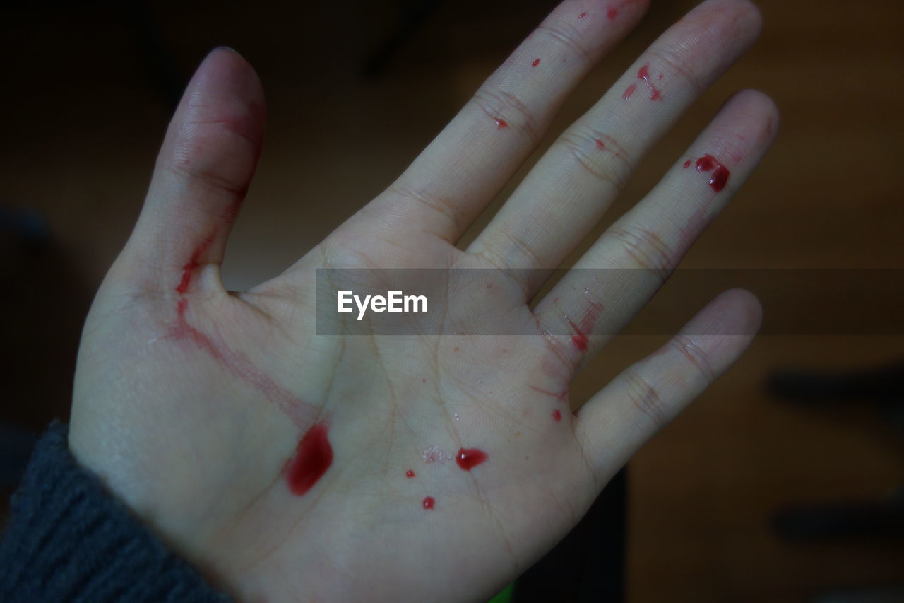 Cropped image of hand with blood