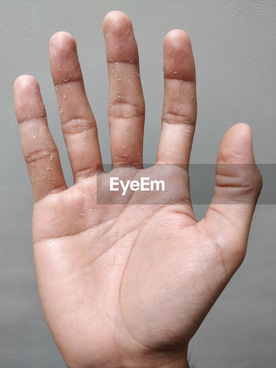 CLOSE-UP OF HUMAN HAND AGAINST WHITE BACKGROUND