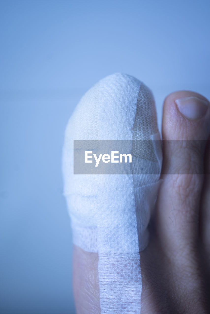 finger, hand, limb, blue, one person, human leg, arm, close-up, colored background, studio shot, adult, human limb, blue background, indoors, healthcare and medicine, physical injury, white