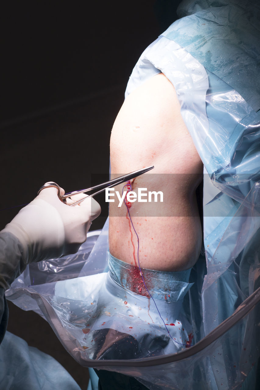 Cropped hand of doctor stitching patient in hospital