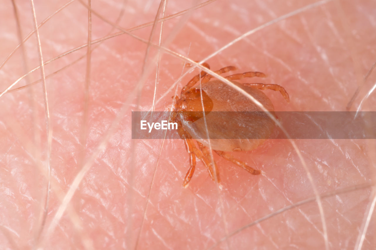 Extreme close-up of tick on human skin