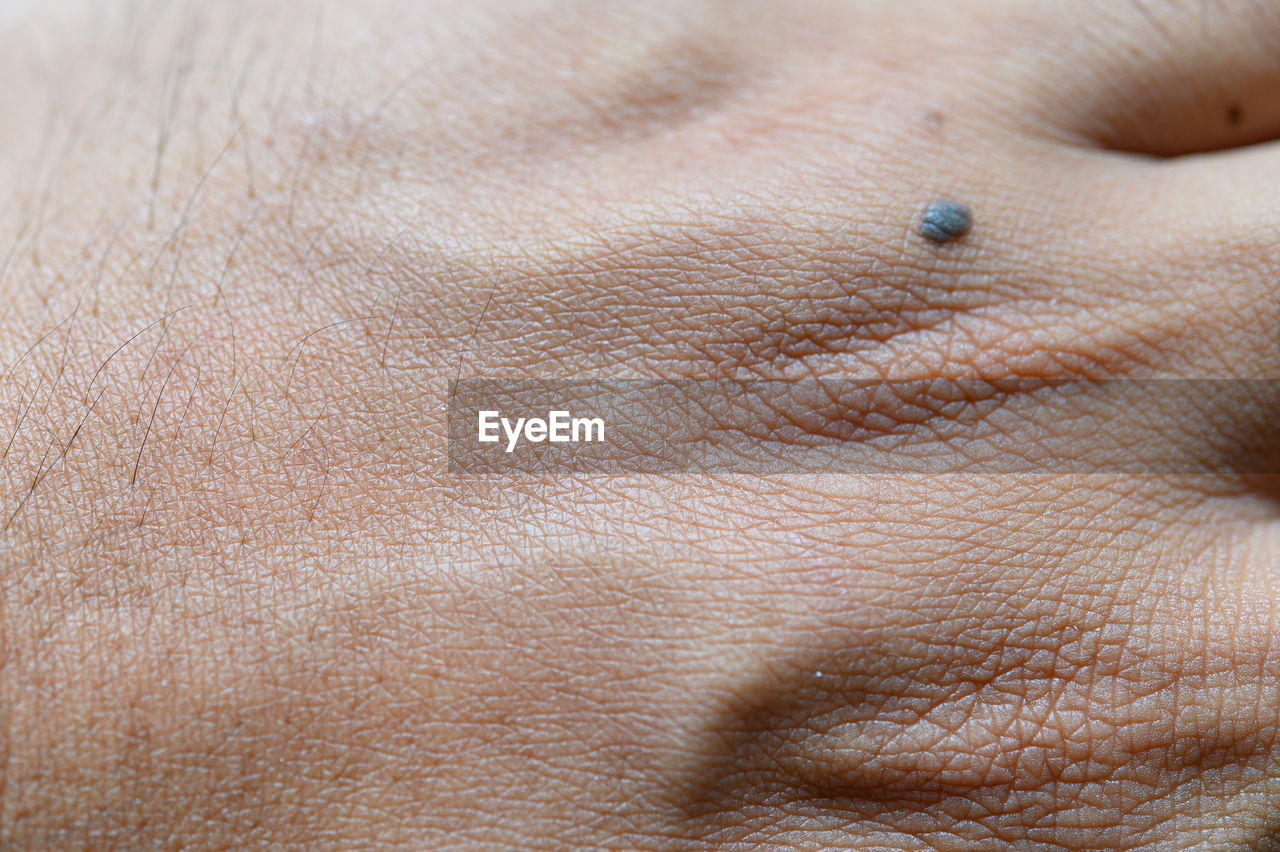CLOSE-UP OF WOMAN HAND WITH BLURRED EYE