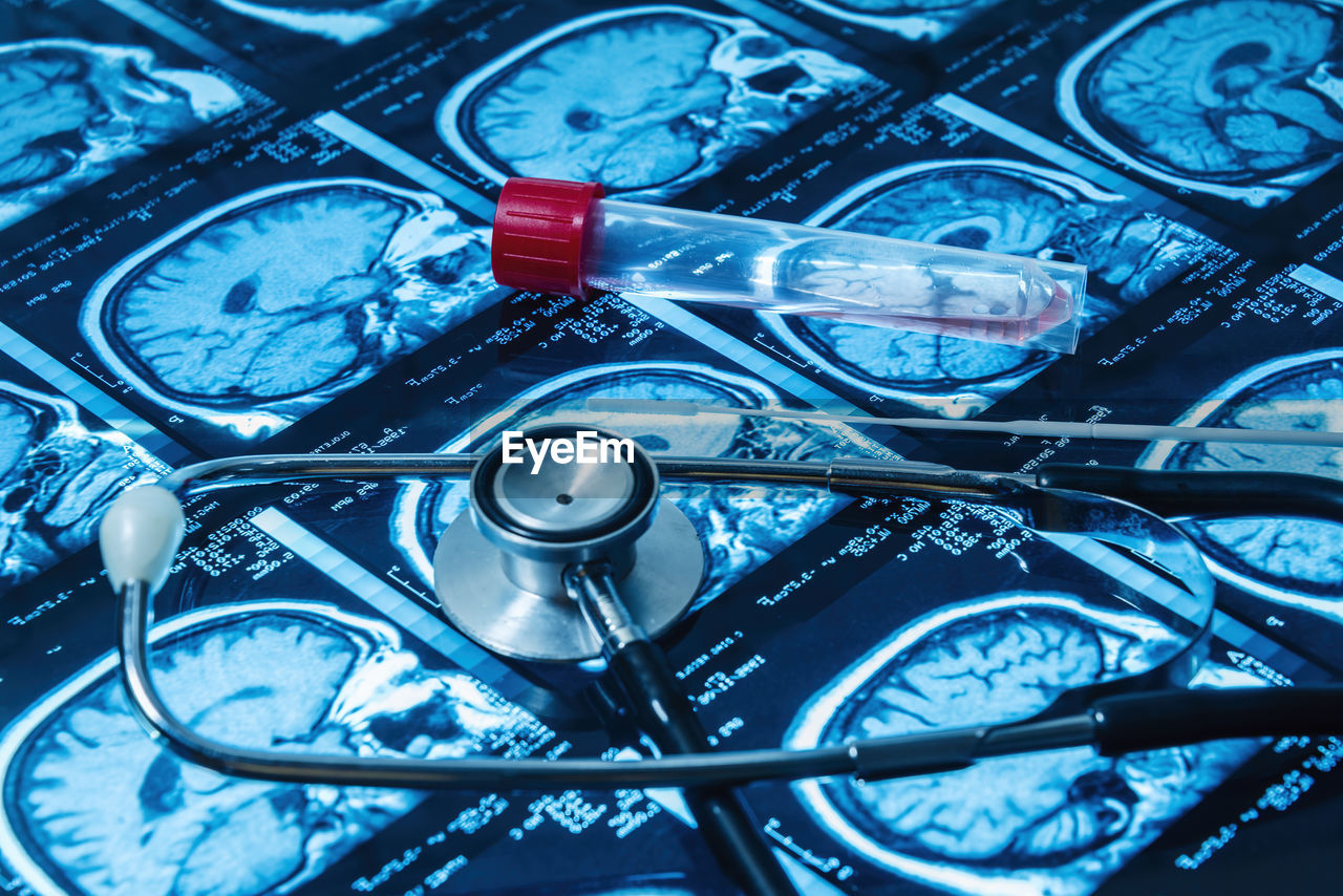 Magnetic resonance fund together with a pcr coronavirus test and a stethoscope selective approach.