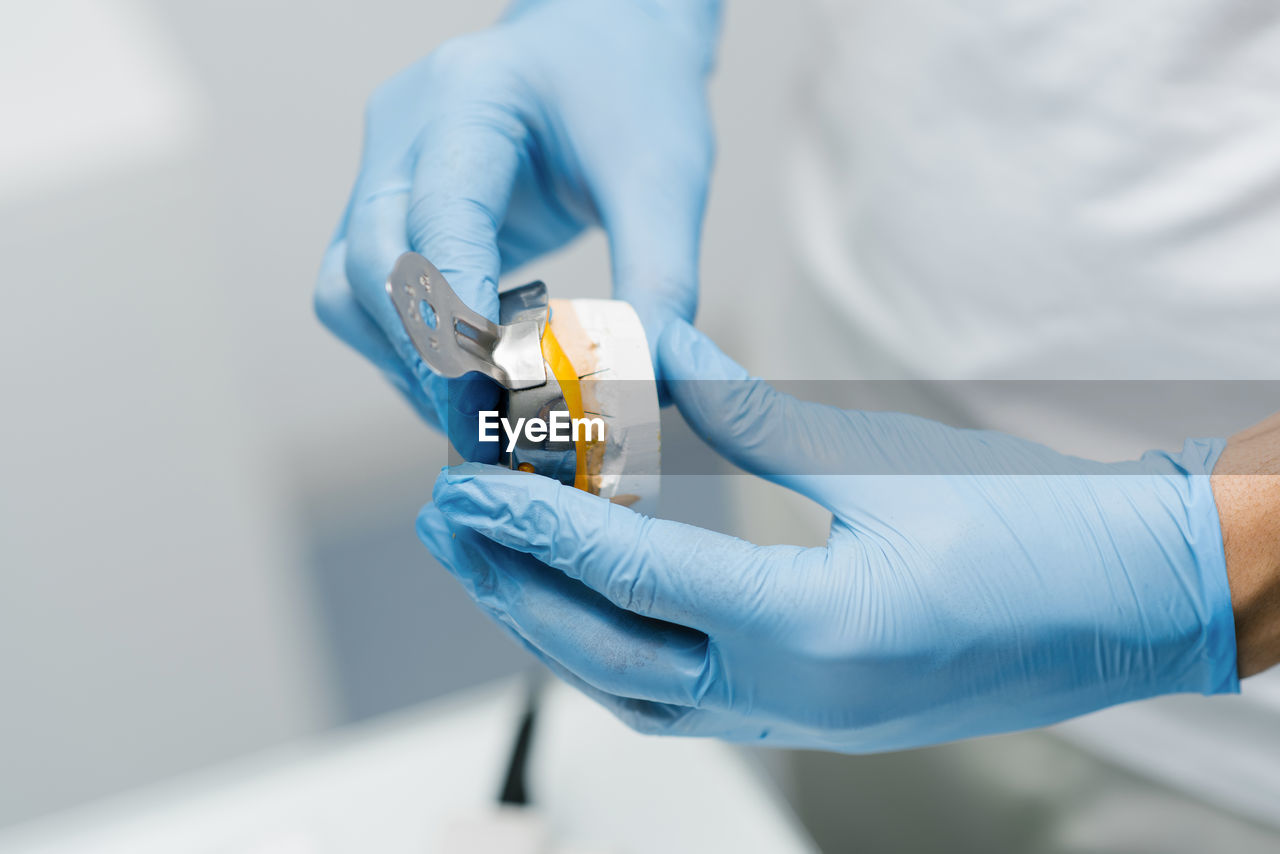 The dentist makes an impression of the teeth. close-up of a dentist in blue gloves