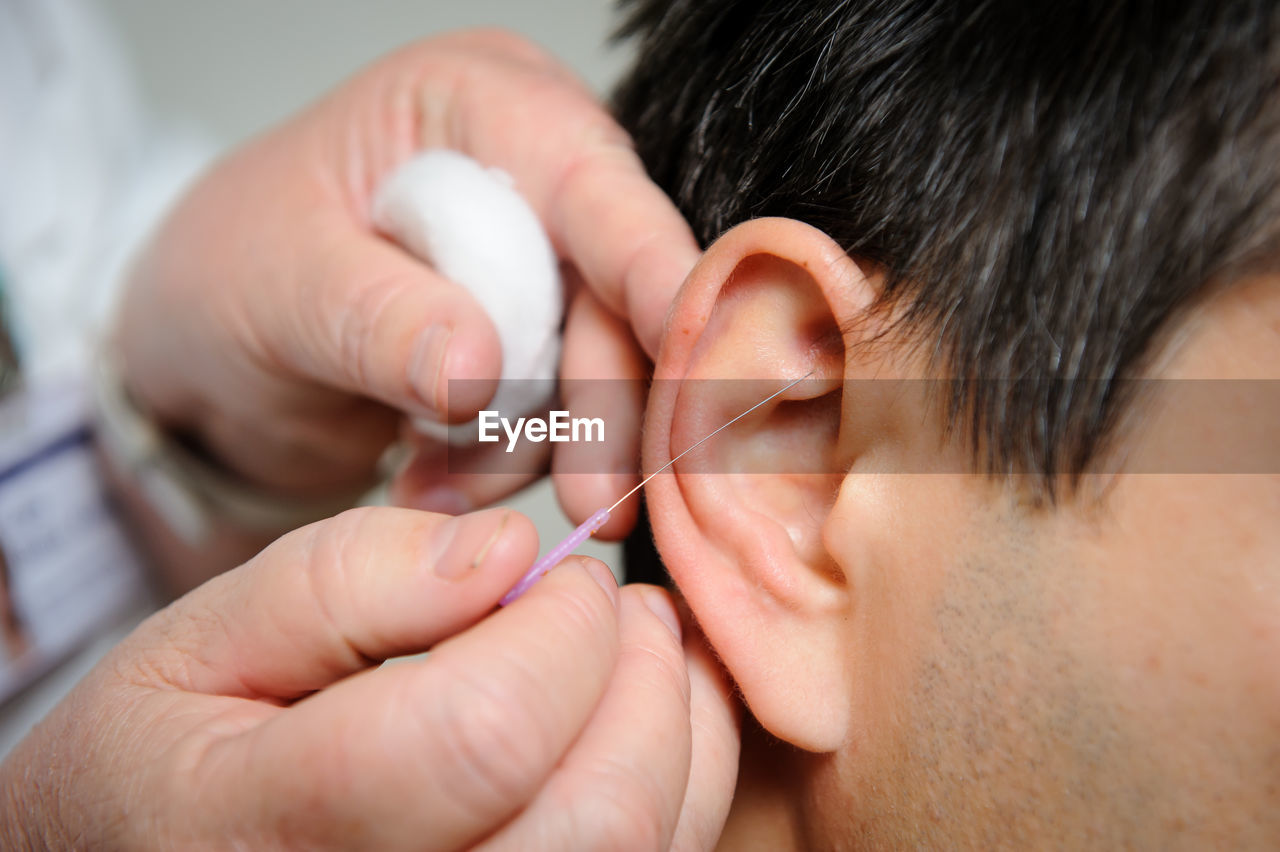 Cropped hands of doctor stitching patient ear at hospital