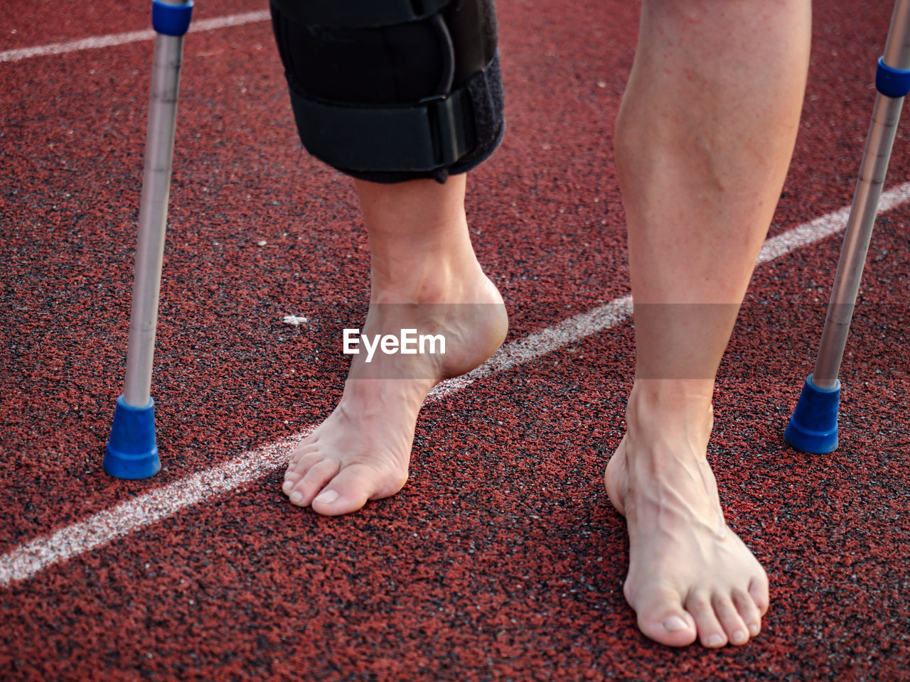 Walk by crutches. woman runner got sports injury running on stadium trail