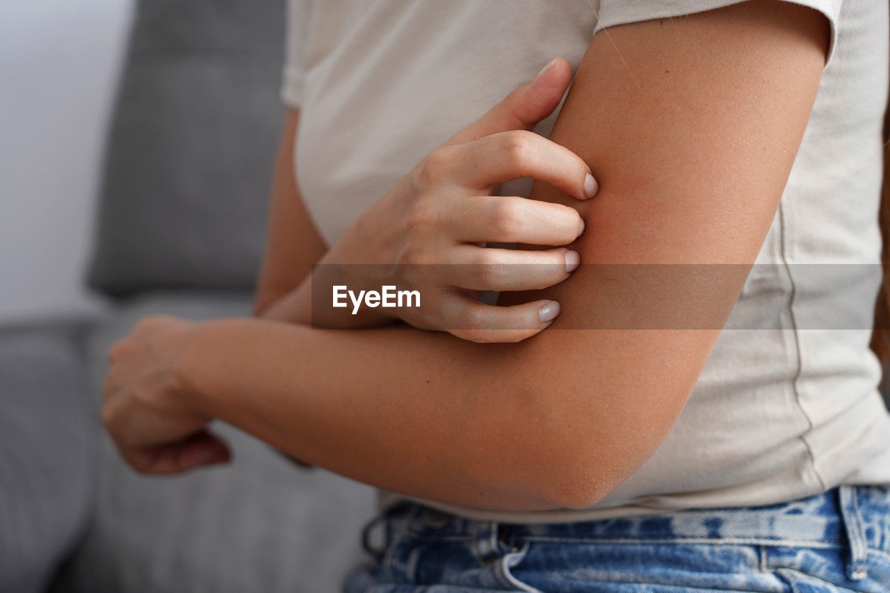 Close-up of unrecognizable woman scratches her arm with her nails. 