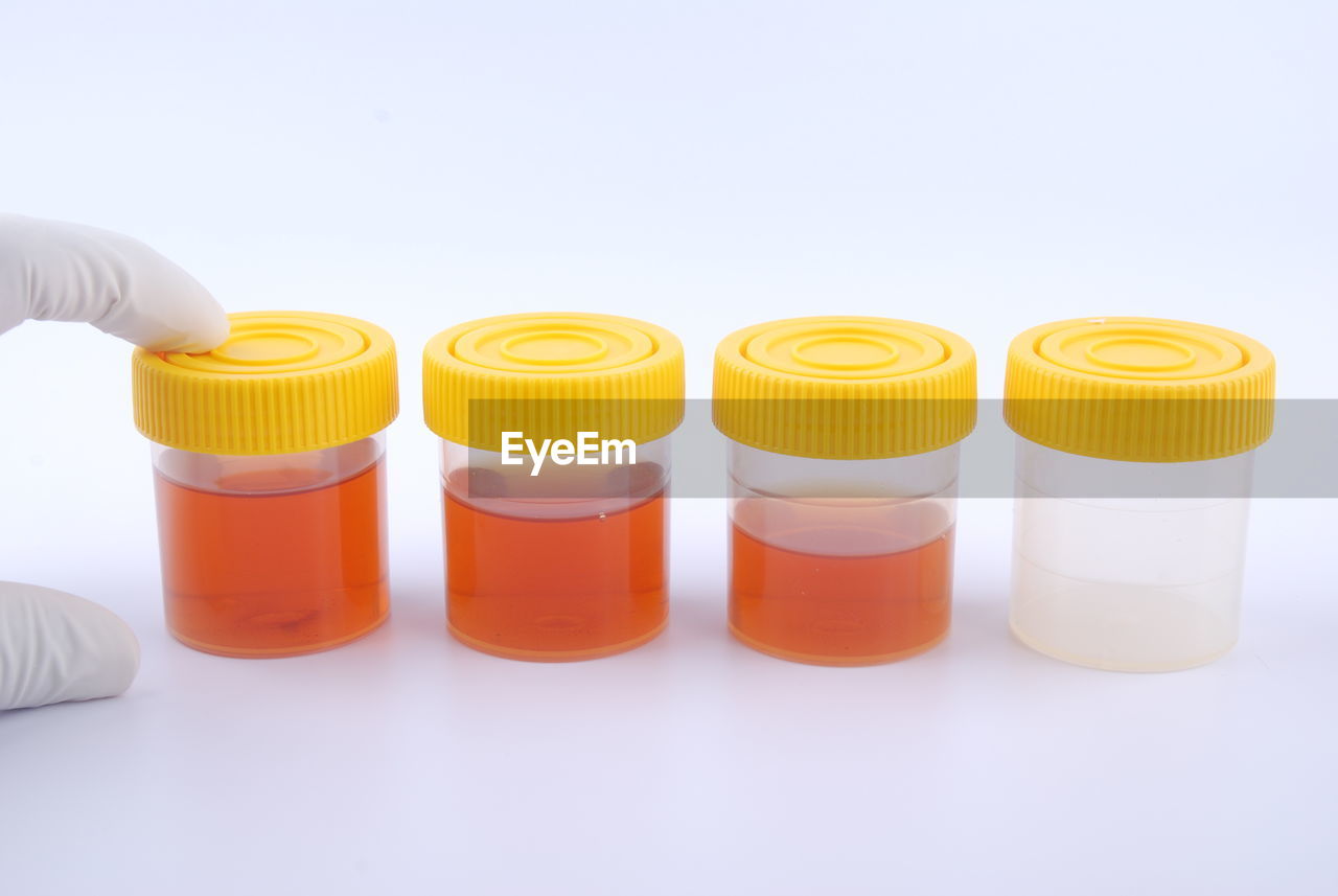 CLOSE-UP OF BOTTLES ON WHITE BACKGROUND