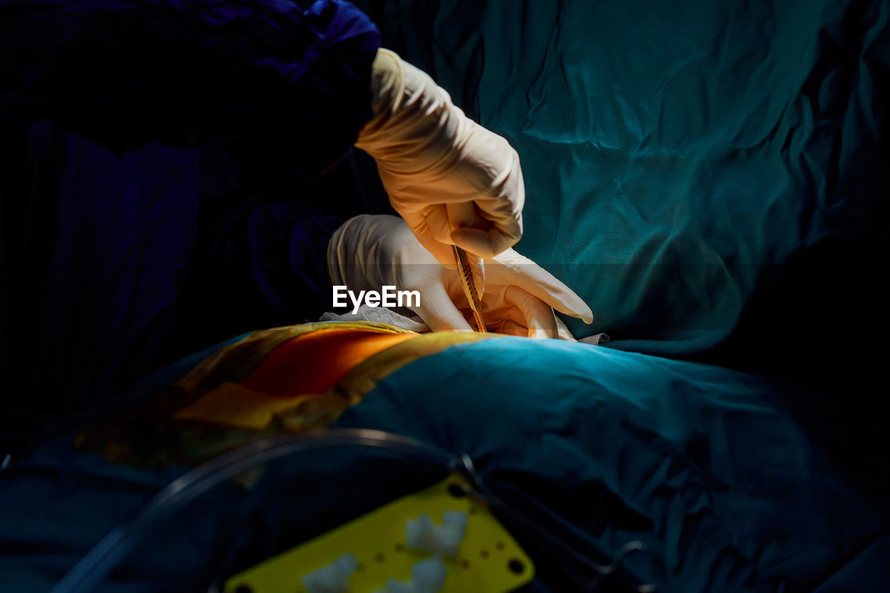 Cropped hands of surgeon doing surgery in operating room