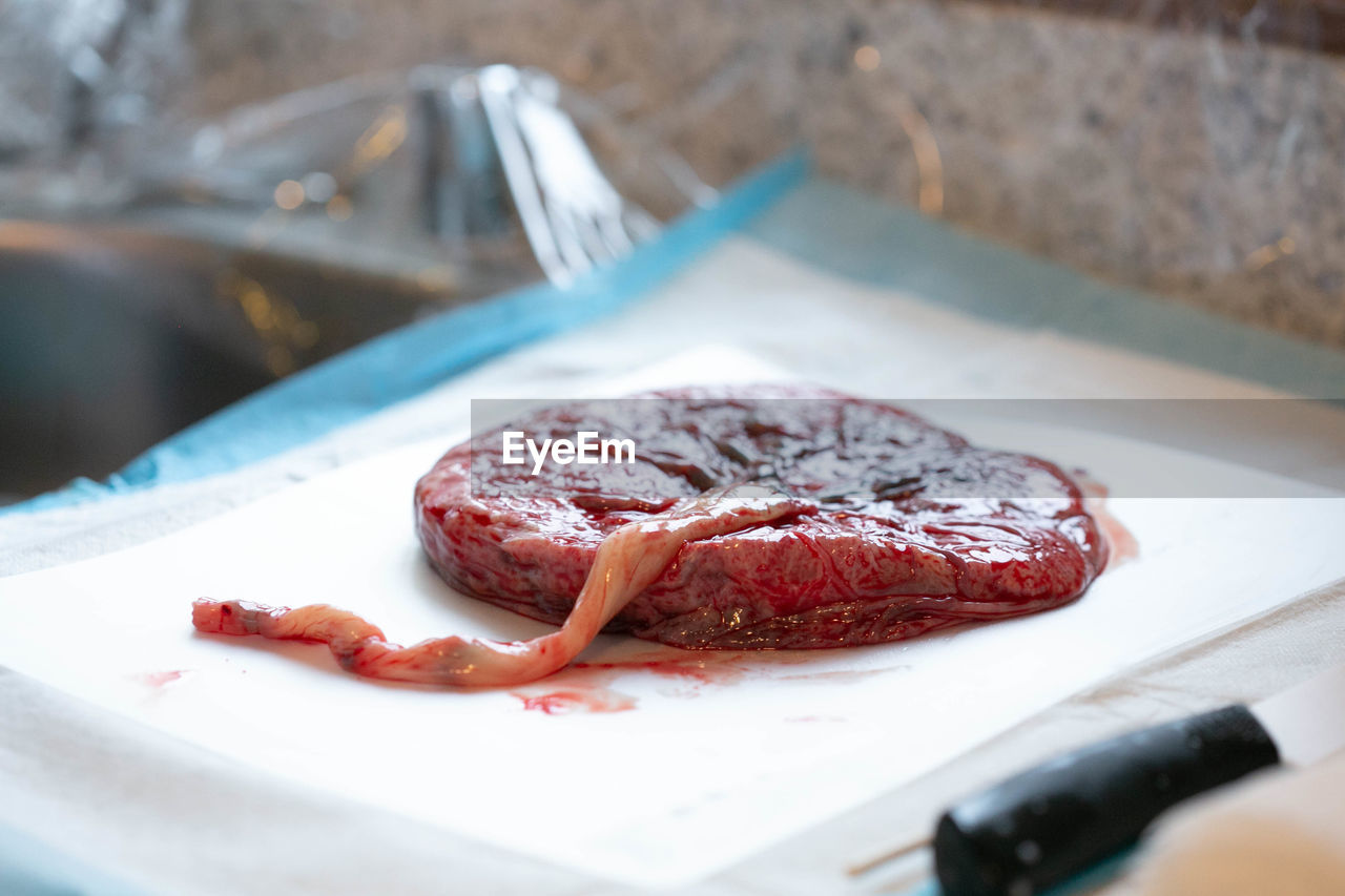 Human placenta lying on white pad on countertop visible umbilical cord