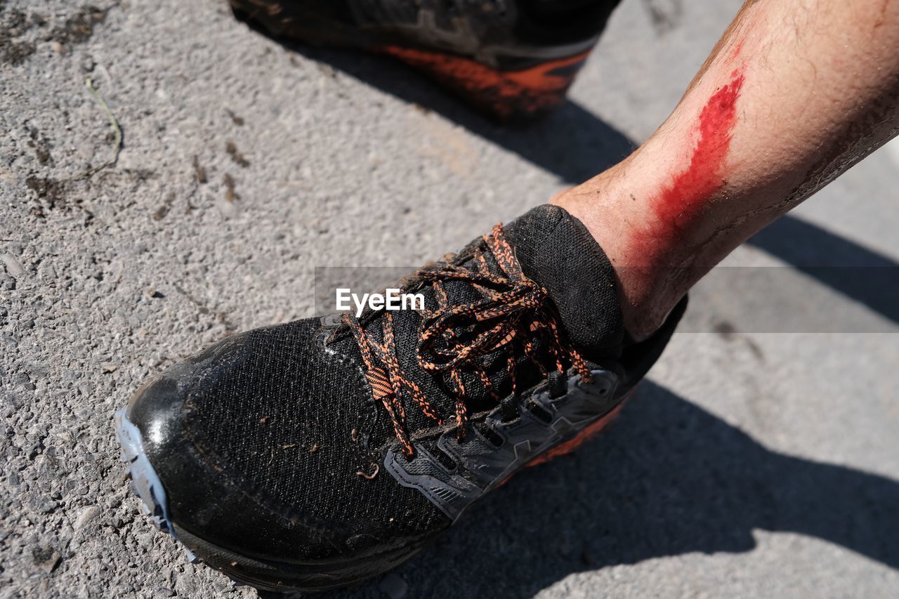 footwear, limb, shoe, black, human leg, one person, human limb, adult, shadow, sunlight, day, arm, men, nature, hand, close-up, low section, outdoors, lifestyles, sock, city, spring, red, sports, street, physical injury