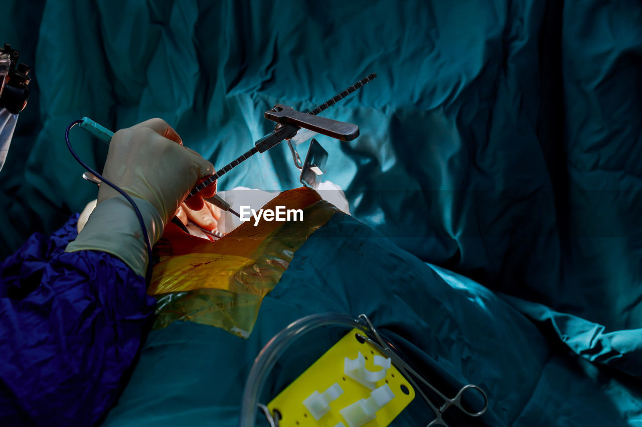 Cropped doctor treating patient in operating room