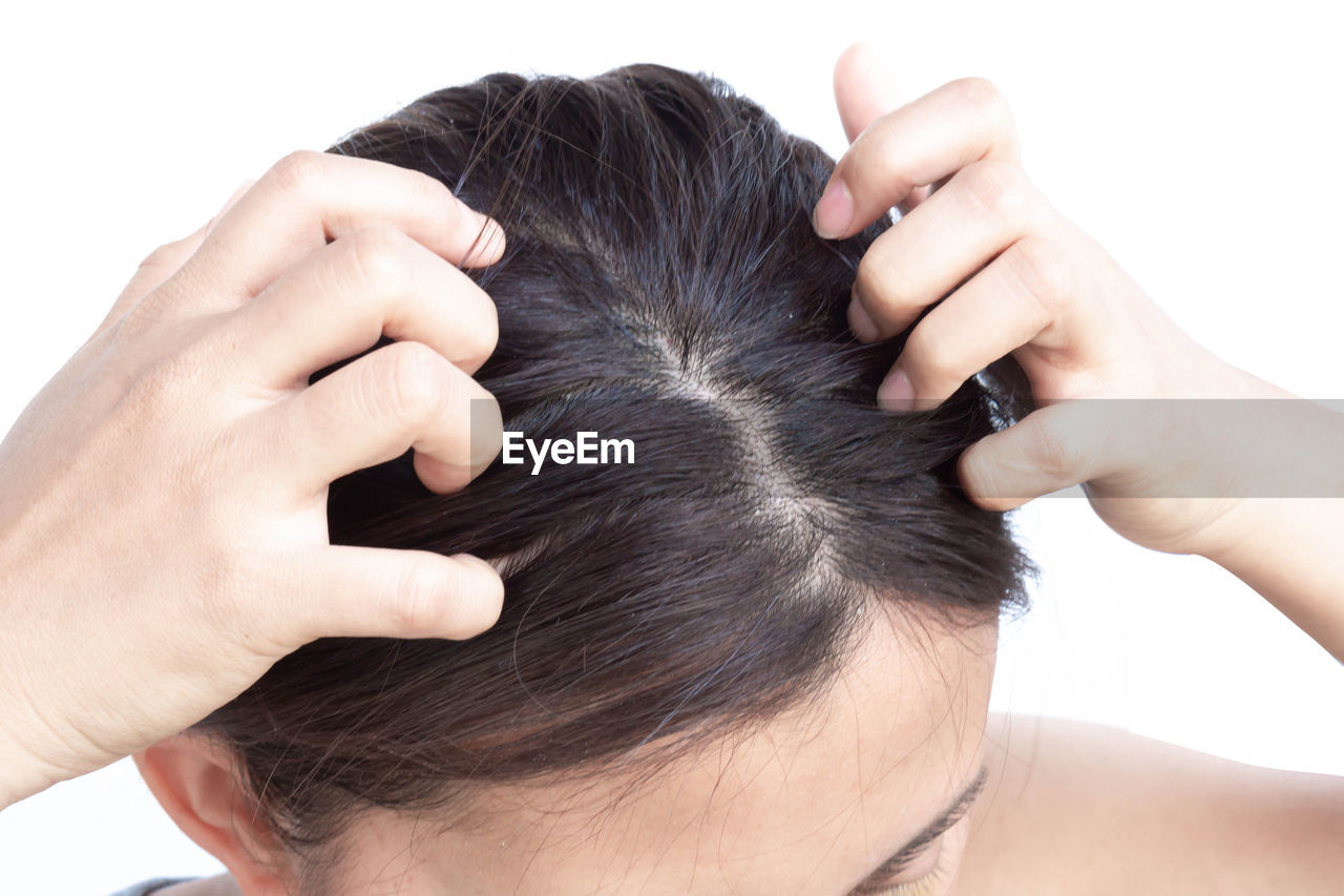 Woman scratching head against white background