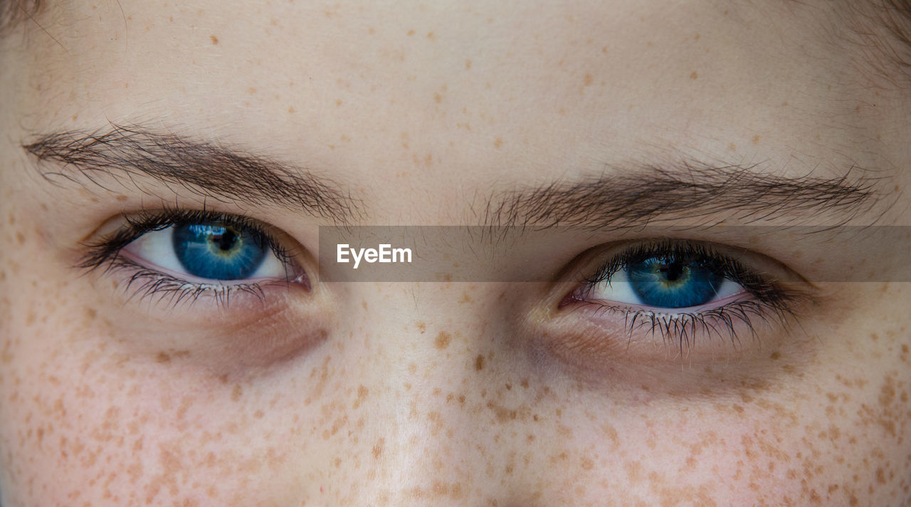 Close-up of woman with blue eyes and freckles