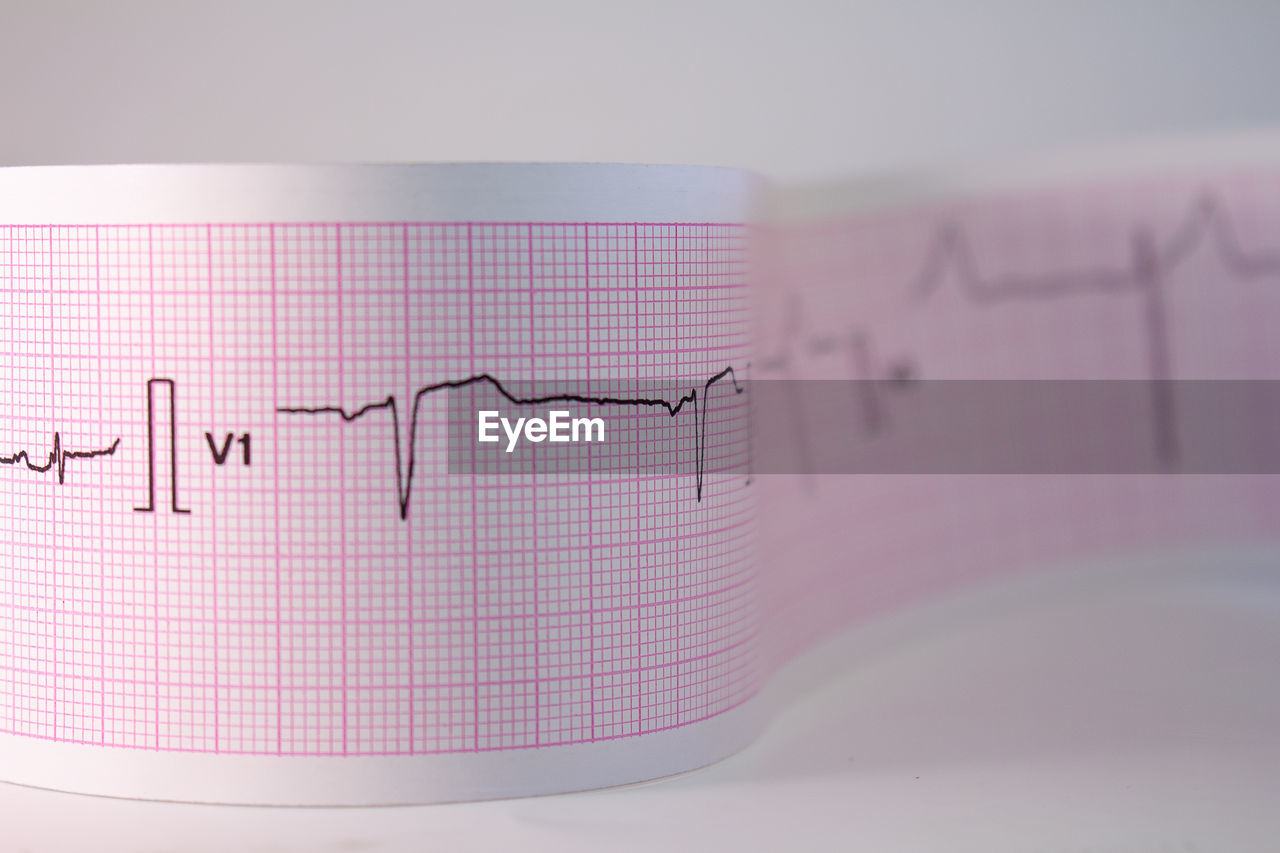 Close-up of pulse trace on graph paper against gray background