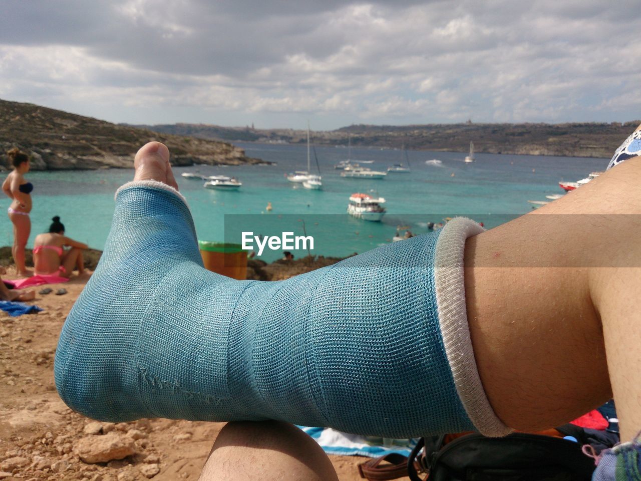 Low section of mature man with bandage relaxing at beach against cloudy sky