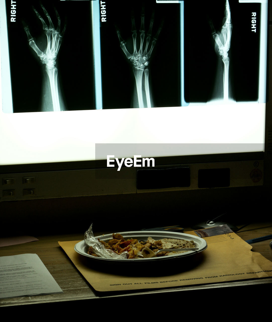 Food in plate on table against x-ray