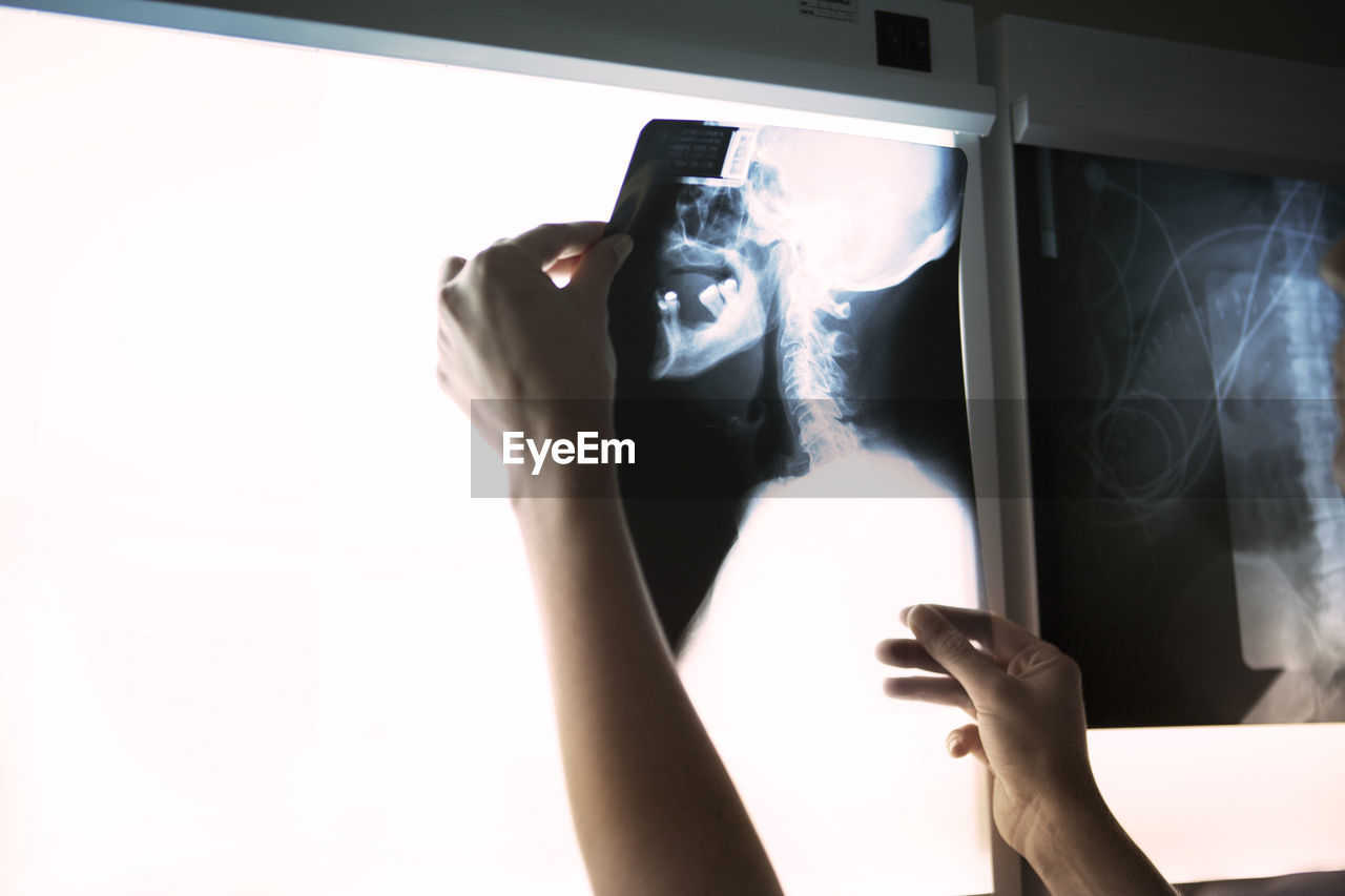 Cropped image of woman examining neck x-ray on diagnostic medical tool