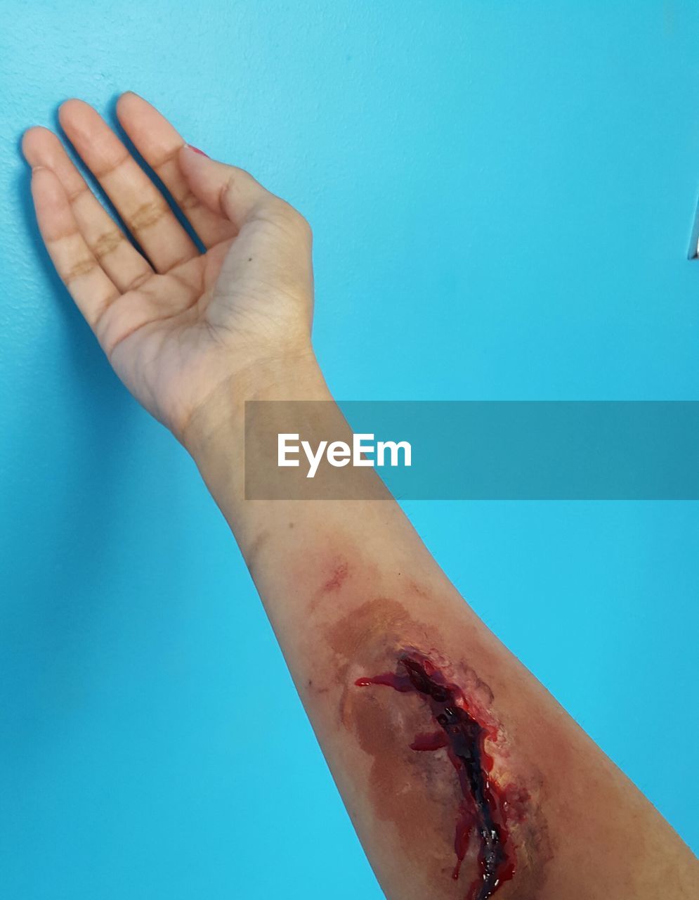 Cropped image of wounded hand on blue wall