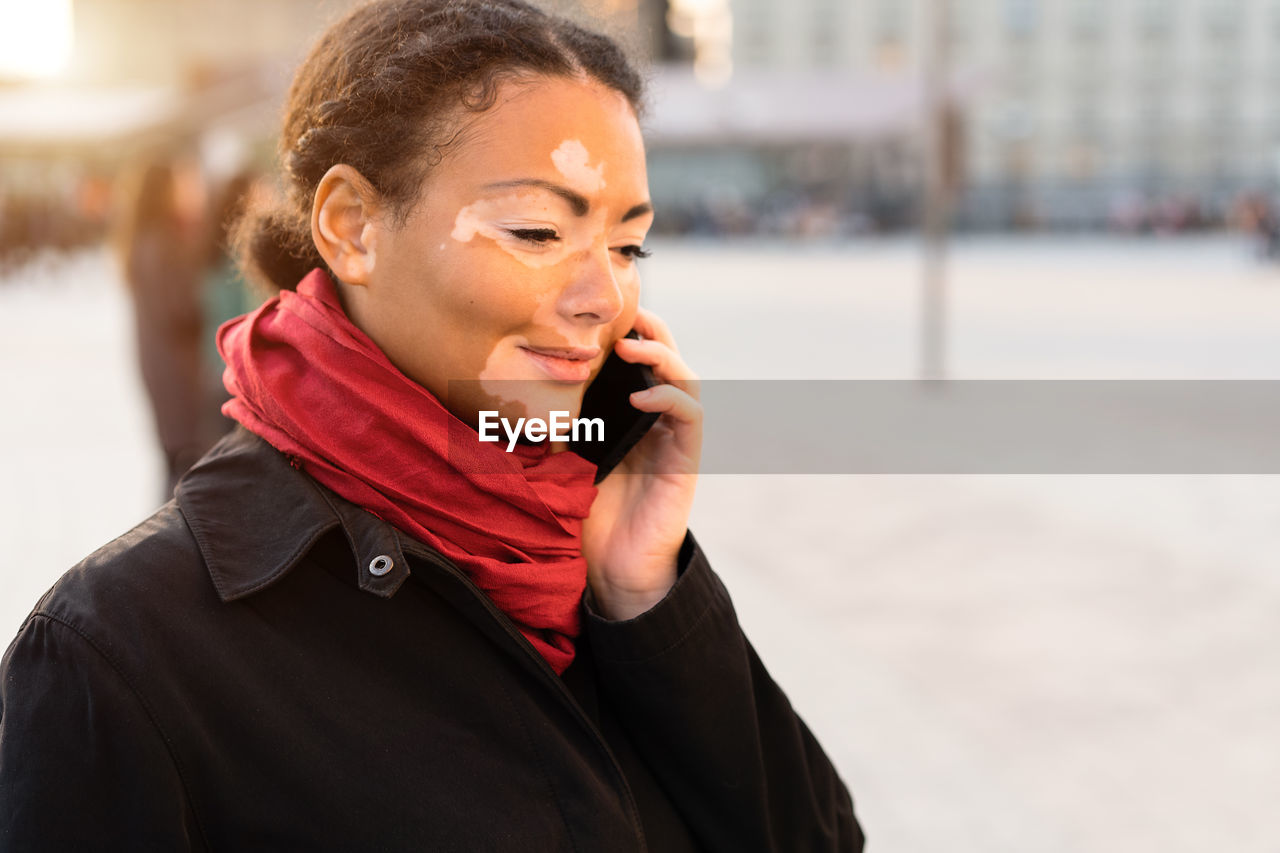 Young woman with vitiligo talking over smart phone while standing on road in city