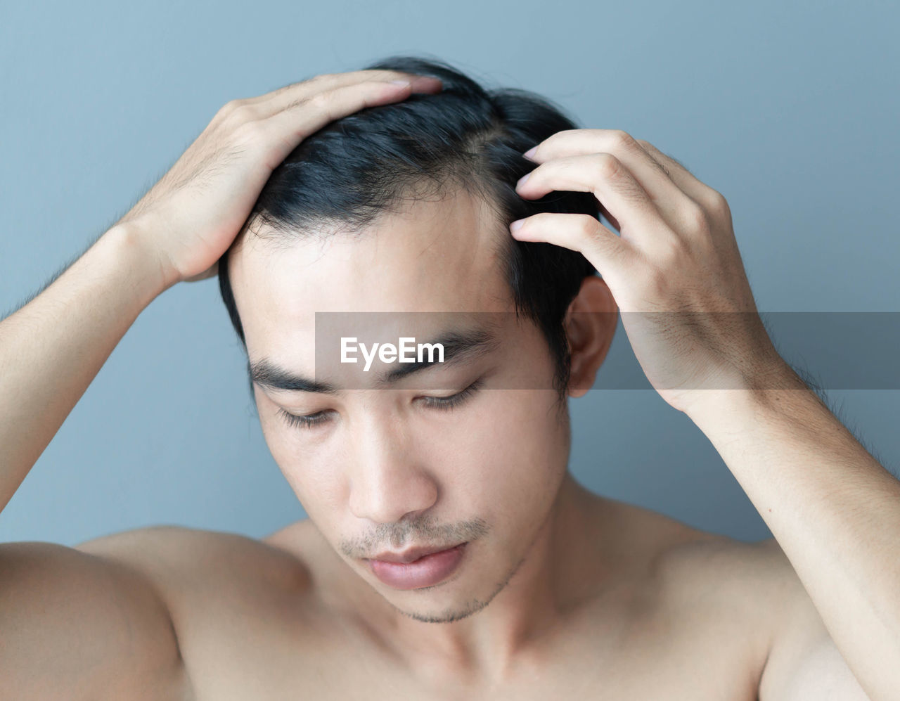 Close-up of man with receding hairline